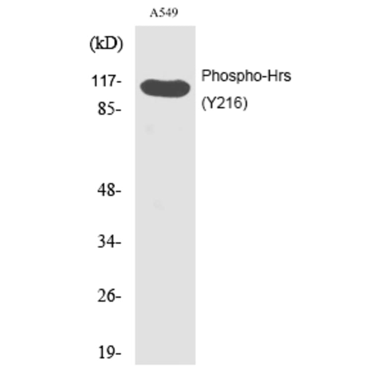 Western blot - Hrs (Phospho-Tyr216) Polyclonal Antibody from Signalway Antibody (12202) - Antibodies.com