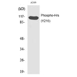 Western blot - Hrs (Phospho-Tyr216) Polyclonal Antibody from Signalway Antibody (12202) - Antibodies.com