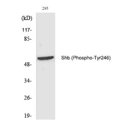 Western blot - Shb (Phospho-Tyr246) Polyclonal Antibody from Signalway Antibody (12221) - Antibodies.com