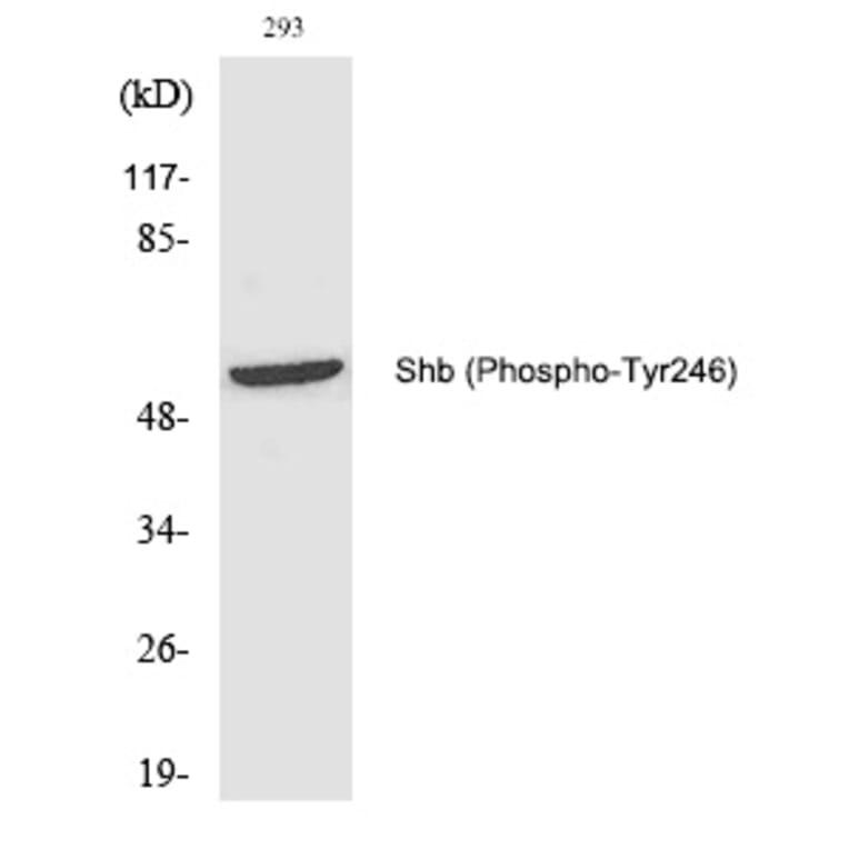 Western blot - Shb (Phospho-Tyr246) Polyclonal Antibody from Signalway Antibody (12221) - Antibodies.com