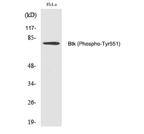 Western blot - Btk (Phospho-Tyr551) Polyclonal Antibody from Signalway Antibody (12223) - Antibodies.com