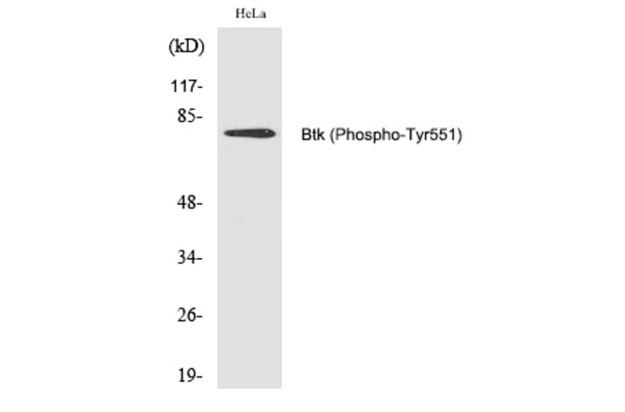 Western blot - Btk (Phospho-Tyr551) Polyclonal Antibody from Signalway Antibody (12223) - Antibodies.com