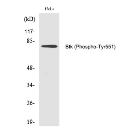 Western blot - Btk (Phospho-Tyr551) Polyclonal Antibody from Signalway Antibody (12223) - Antibodies.com