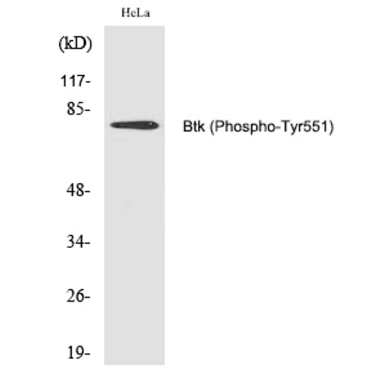 Western blot - Btk (Phospho-Tyr551) Polyclonal Antibody from Signalway Antibody (12223) - Antibodies.com