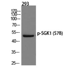 Western blot - SGK1 (Phospho-Ser78) Polyclonal Antibody from Signalway Antibody (12234) - Antibodies.com