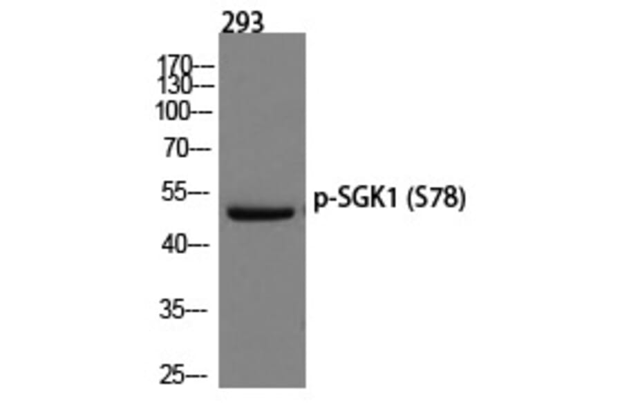 Western blot - SGK1 (Phospho-Ser78) Polyclonal Antibody from Signalway Antibody (12234) - Antibodies.com