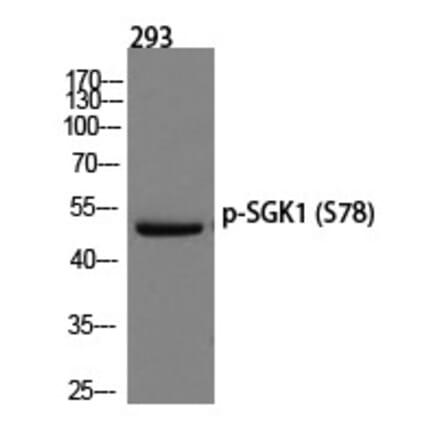 Western blot - SGK1 (Phospho-Ser78) Polyclonal Antibody from Signalway Antibody (12234) - Antibodies.com