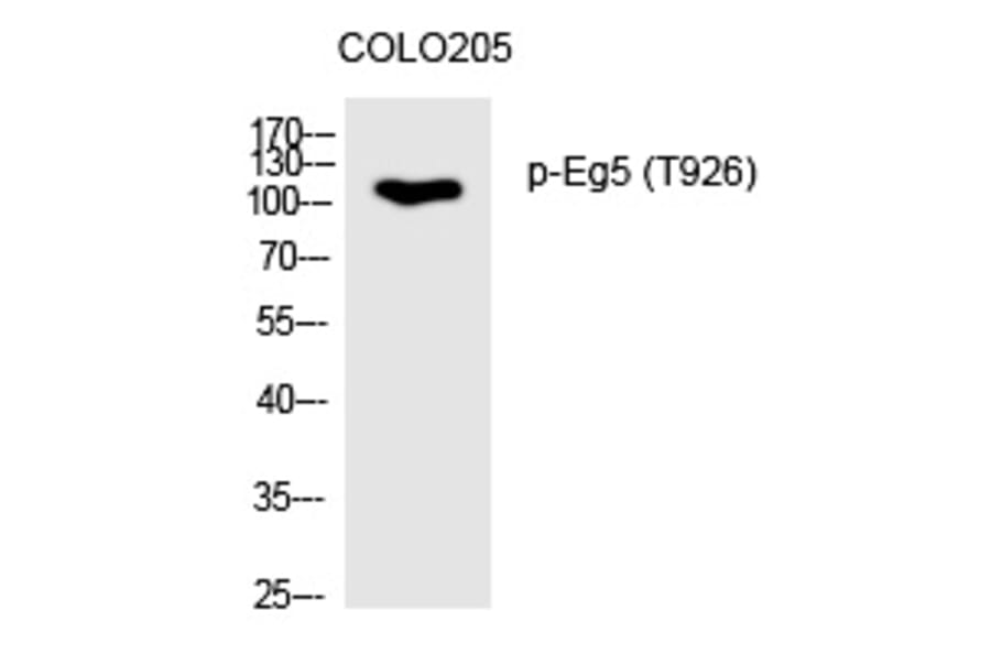 Western blot - Eg5 (Phospho-Thr926) Polyclonal Antibody from Signalway Antibody (12244) - Antibodies.com