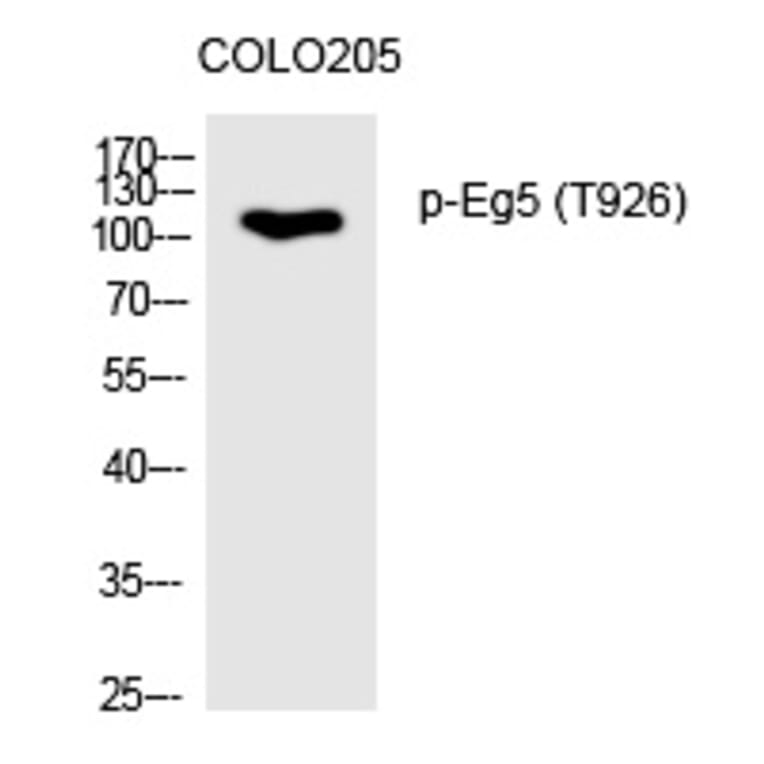 Western blot - Eg5 (Phospho-Thr926) Polyclonal Antibody from Signalway Antibody (12244) - Antibodies.com