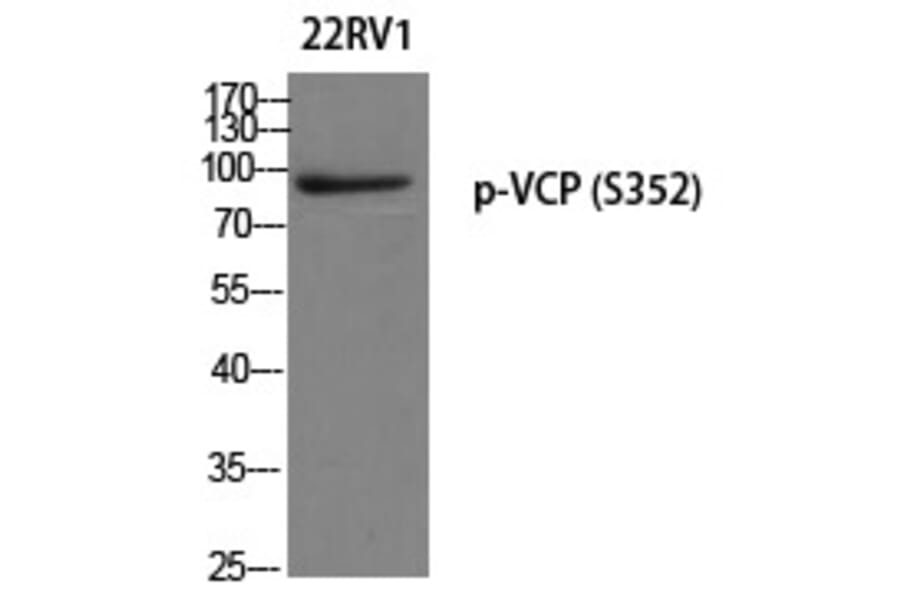 Western blot - VCP (Phospho-Ser352) Polyclonal Antibody from Signalway Antibody (12263) - Antibodies.com
