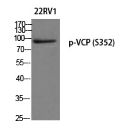 Western blot - VCP (Phospho-Ser352) Polyclonal Antibody from Signalway Antibody (12263) - Antibodies.com