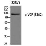 Western blot - VCP (Phospho-Ser352) Polyclonal Antibody from Signalway Antibody (12263) - Antibodies.com