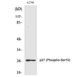 Western blot - p27 (Phospho-Ser10) Polyclonal Antibody from Signalway Antibody (12213) - Antibodies.com