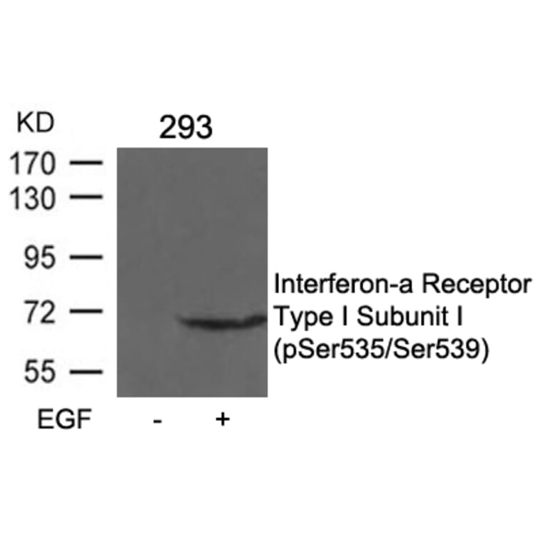 Western blot - IFNAR1 Subunit1 (phospho-Ser535/Ser539) Antibody from Signalway Antibody (11558) - Antibodies.com