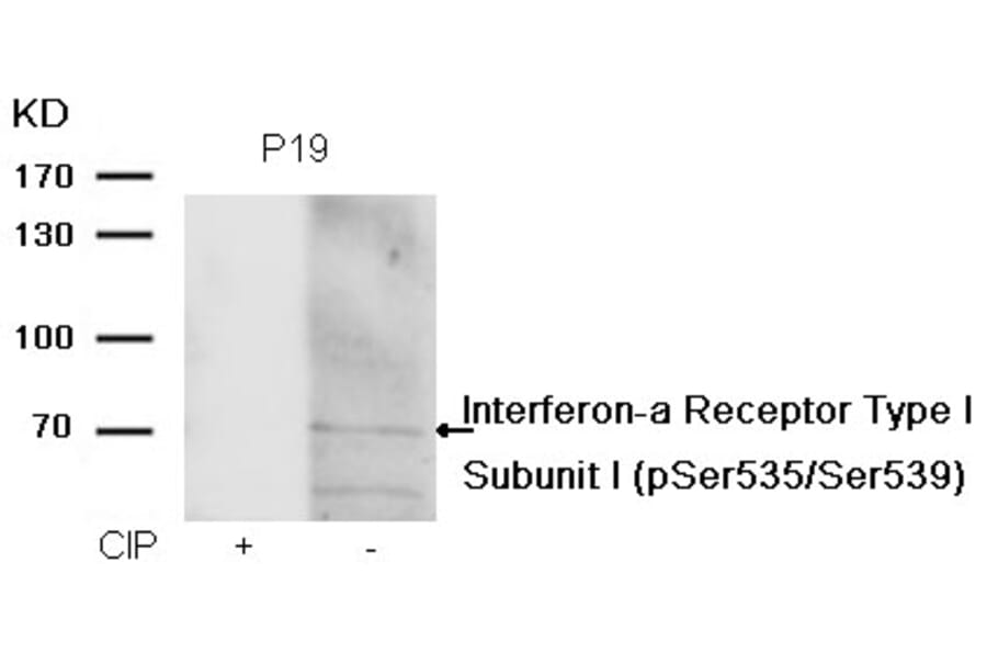 Western blot - IFNAR1 Subunit1 (phospho-Ser535/Ser539) Antibody from Signalway Antibody (11558) - Antibodies.com