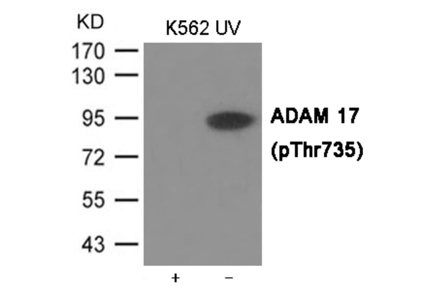 Western blot - ADAM 17 (Phospho-Thr735) Antibody from Signalway Antibody (12033) - Antibodies.com