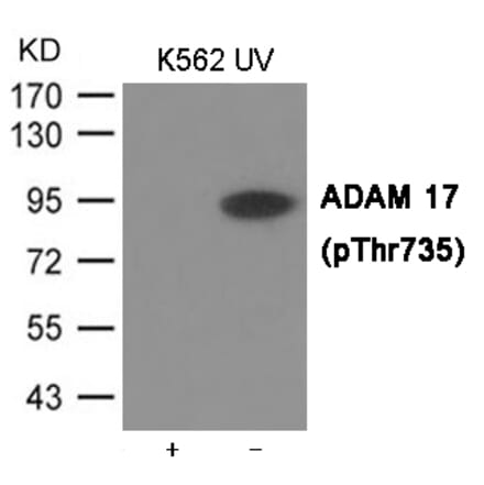 Western blot - ADAM 17 (Phospho-Thr735) Antibody from Signalway Antibody (12033) - Antibodies.com