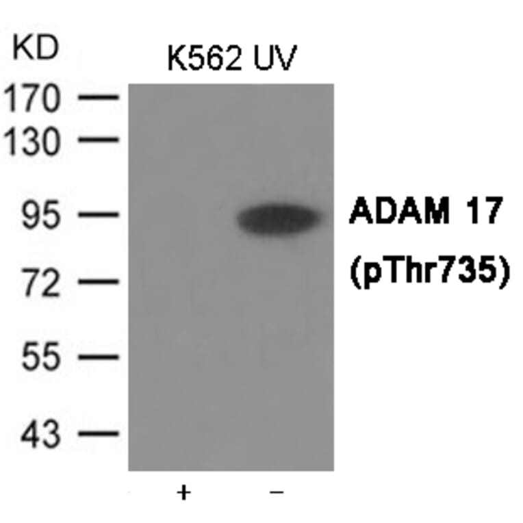 Western blot - ADAM 17 (Phospho-Thr735) Antibody from Signalway Antibody (12033) - Antibodies.com