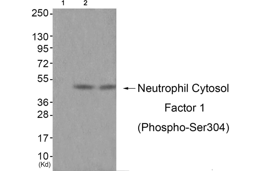 Western blot - Neutrophil Cytosol Factor 1 (Phospho-Ser304) Antibody from Signalway Antibody - Antibodies.com