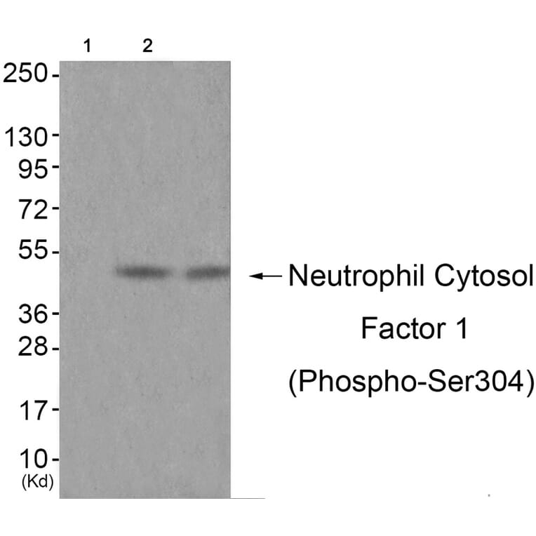 Western blot - Neutrophil Cytosol Factor 1 (Phospho-Ser304) Antibody from Signalway Antibody - Antibodies.com