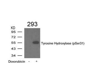 Western blot - Tyrosine Hydroxylase (Phospho-Ser31) Antibody from Signalway Antibody (11211) - Antibodies.com