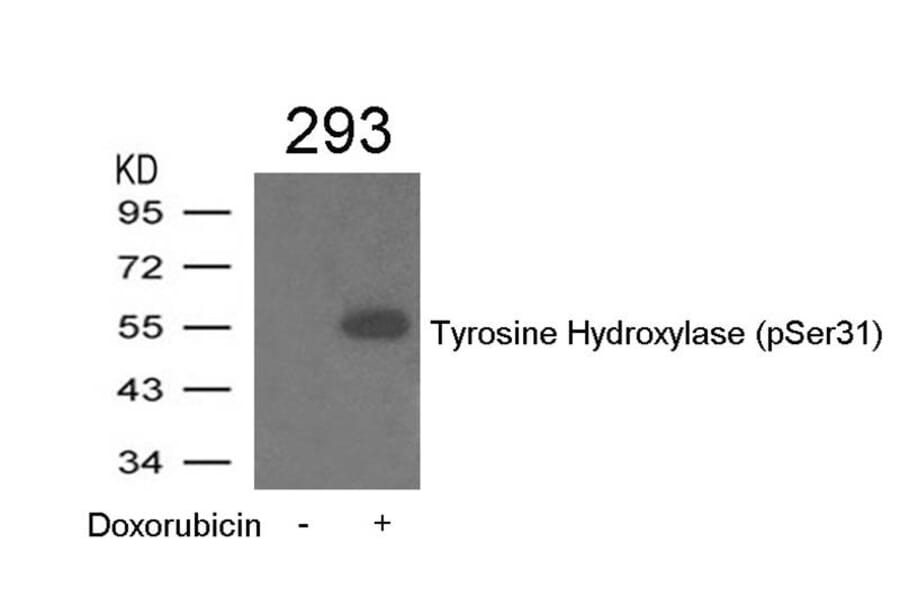 Western blot - Tyrosine Hydroxylase (Phospho-Ser31) Antibody from Signalway Antibody (11211) - Antibodies.com