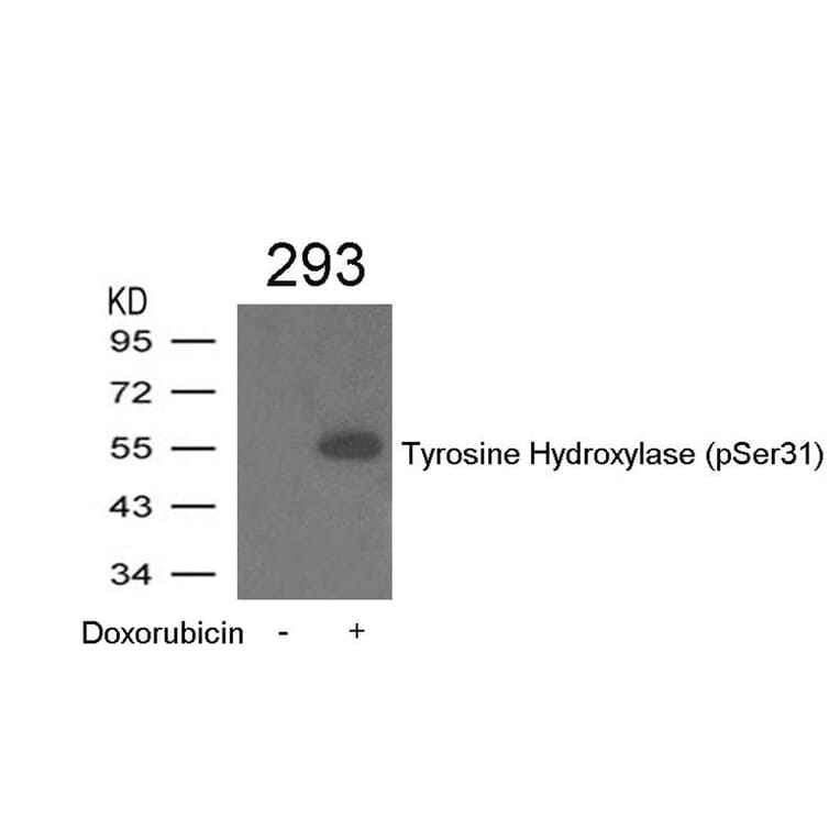 Western blot - Tyrosine Hydroxylase (Phospho-Ser31) Antibody from Signalway Antibody (11211) - Antibodies.com
