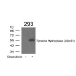 Western blot - Tyrosine Hydroxylase (Phospho-Ser31) Antibody from Signalway Antibody (11211) - Antibodies.com