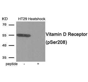 Western blot - Vitamin D Receptor (Phospho-Ser208) Antibody from Signalway Antibody (11994) - Antibodies.com