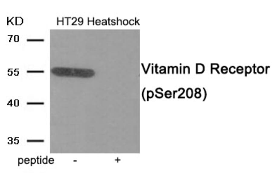 Western blot - Vitamin D Receptor (Phospho-Ser208) Antibody from Signalway Antibody (11994) - Antibodies.com