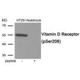 Western blot - Vitamin D Receptor (Phospho-Ser208) Antibody from Signalway Antibody (11994) - Antibodies.com