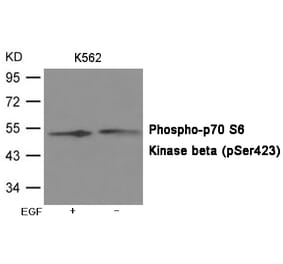 Western blot - p70 S6 Kinase beta (Phospho-Ser423) Antibody from Signalway Antibody (12066) - Antibodies.com