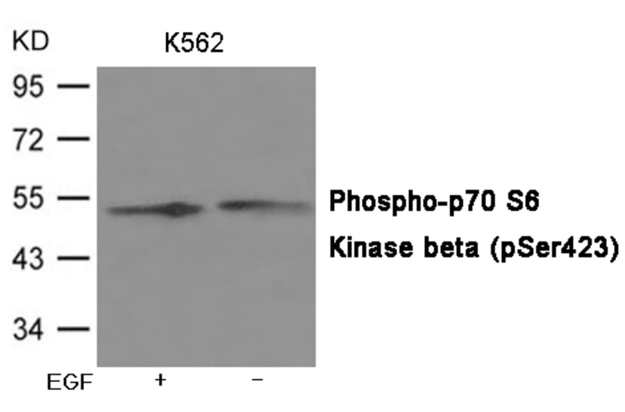 Western blot - p70 S6 Kinase beta (Phospho-Ser423) Antibody from Signalway Antibody (12066) - Antibodies.com