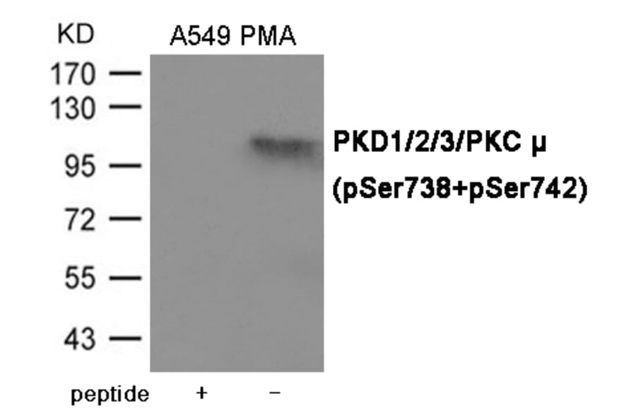 Western blot - PKD1/2/3/PKC μ (Phospho-Ser738/742) Antibody from Signalway Antibody (12079) - Antibodies.com