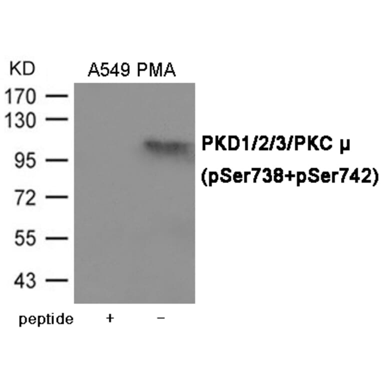 Western blot - PKD1/2/3/PKC μ (Phospho-Ser738/742) Antibody from Signalway Antibody (12079) - Antibodies.com