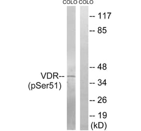 Western blot - Vitamin D3 Receptor (Phospho-Ser51) Antibody from Signalway Antibody (12155) - Antibodies.com