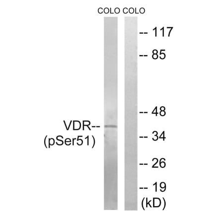 Western blot - Vitamin D3 Receptor (Phospho-Ser51) Antibody from Signalway Antibody (12155) - Antibodies.com