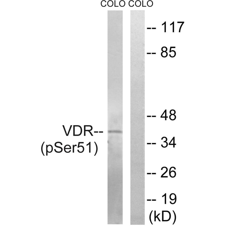 Western blot - Vitamin D3 Receptor (Phospho-Ser51) Antibody from Signalway Antibody (12155) - Antibodies.com