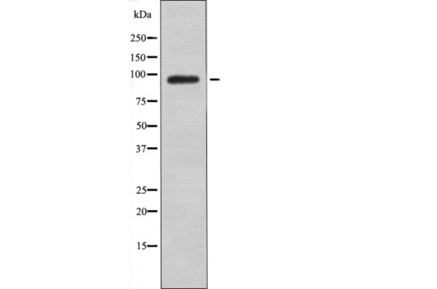 Western blot - FGFR1/2/3/4 (Phospho-Tyr653+Tyr654) Antibody from Signalway Antibody (12550) - Antibodies.com