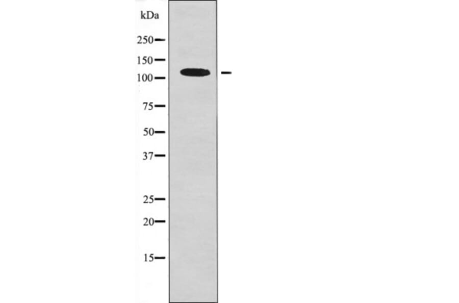 Western blot - EPH B1/3/4 (Phospho-Tyr778/792/774) Antibody from Signalway Antibody (12561) - Antibodies.com