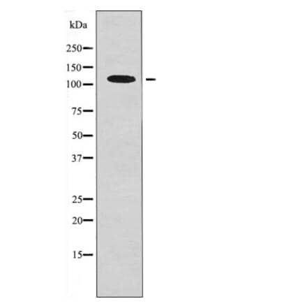 Western blot - EPH B1/3/4 (Phospho-Tyr778/792/774) Antibody from Signalway Antibody (12561) - Antibodies.com