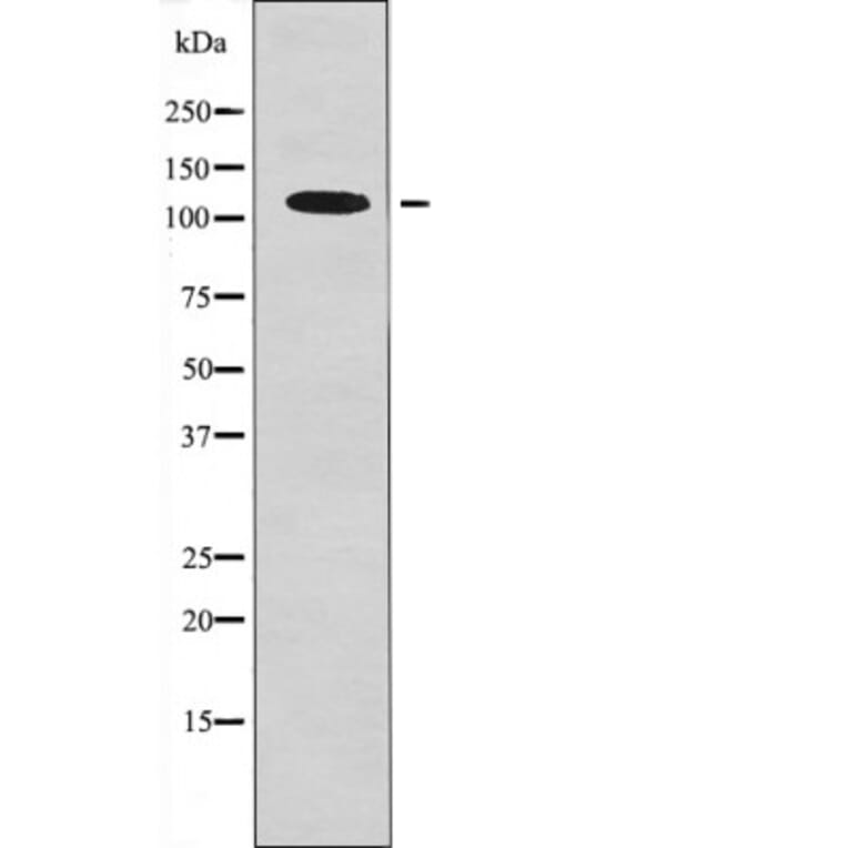 Western blot - EPH B1/3/4 (Phospho-Tyr778/792/774) Antibody from Signalway Antibody (12561) - Antibodies.com