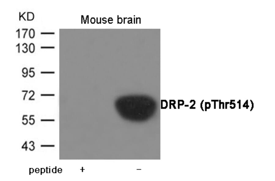 Western blot - DRP-2 (Phospho-Thr514) Antibody from Signalway Antibody (12055) - Antibodies.com
