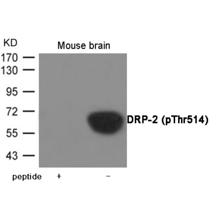 Western blot - DRP-2 (Phospho-Thr514) Antibody from Signalway Antibody (12055) - Antibodies.com