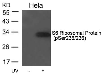 Western blot analysis of extracts from Hela cells untreated or treated with UV using S6 Ribosomal Protein (Phospho-Ser235/236) Antibody #11580.
