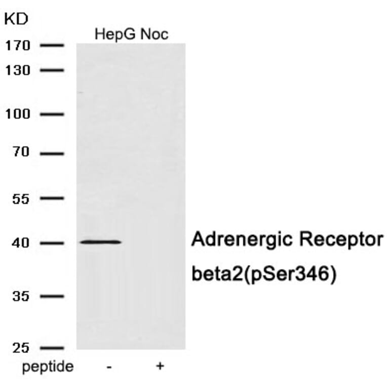 Western blot - Adrenergic Receptor beta2 (Phospho-Ser346) Antibody from Signalway Antibody (11970) - Antibodies.com