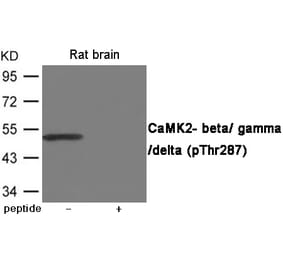 Western blot - CaMK2- beta/ gamma/ delta (Phospho-Thr287) Antibody from Signalway Antibody (12065) - Antibodies.com