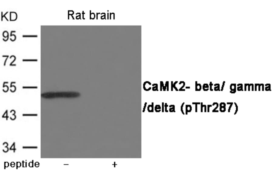 Western blot - CaMK2- beta/ gamma/ delta (Phospho-Thr287) Antibody from Signalway Antibody (12065) - Antibodies.com