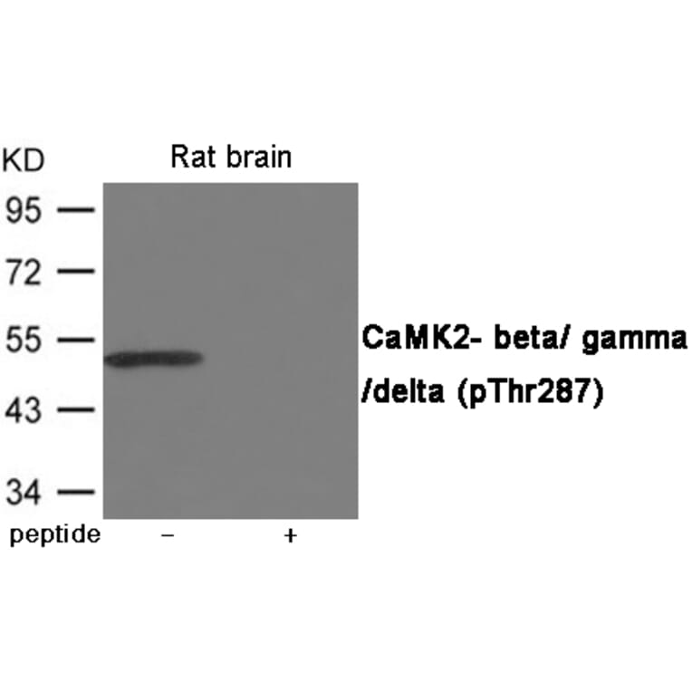 Western blot - CaMK2- beta/ gamma/ delta (Phospho-Thr287) Antibody from Signalway Antibody (12065) - Antibodies.com