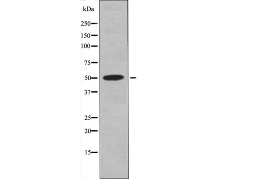 Western blot - Retinoic Acid Receptor α/β (Phospho-Ser96) Antibody from Signalway Antibody (12545)